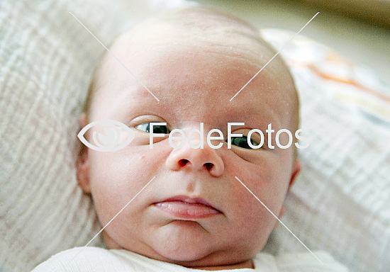 Skeløjet baby 